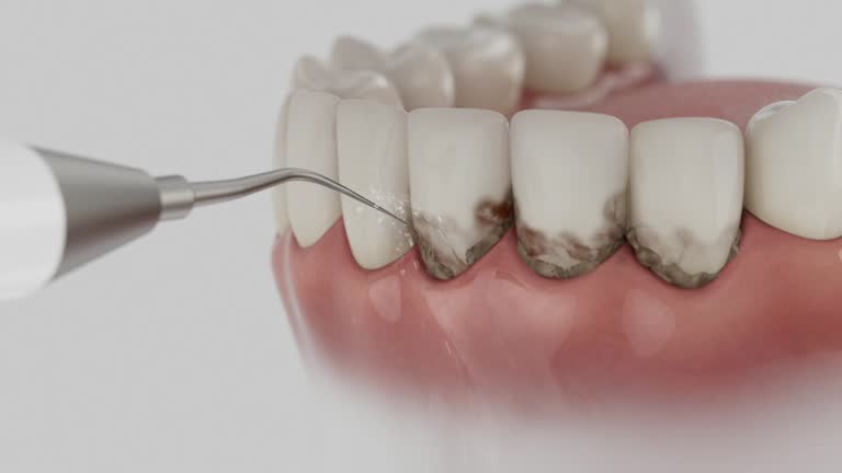 Trusted Root Canal Treatment service in Wisconsin Rapids, WI - Dentist Open Now